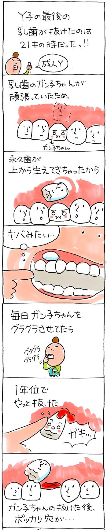 歯の話01